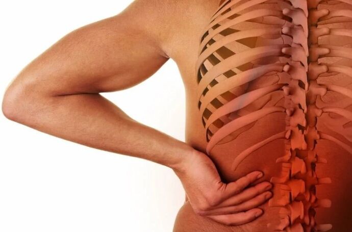 Lumbar օստեոխոնդրոզ